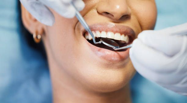 Best Emergency Dental Care for Sports Injuries in Hoback, WY